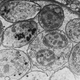 A close-up look at a tissue cyst of T. gondii under a microscope